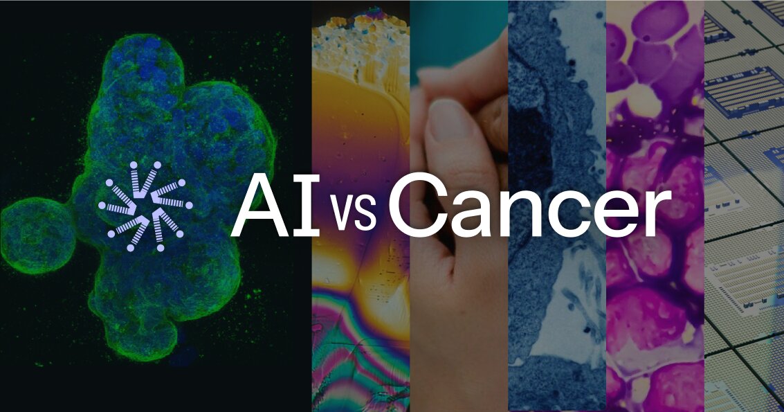 AI shows promise in cancer research but faces significant limitations in translating lab discoveries to actual patient treatments.