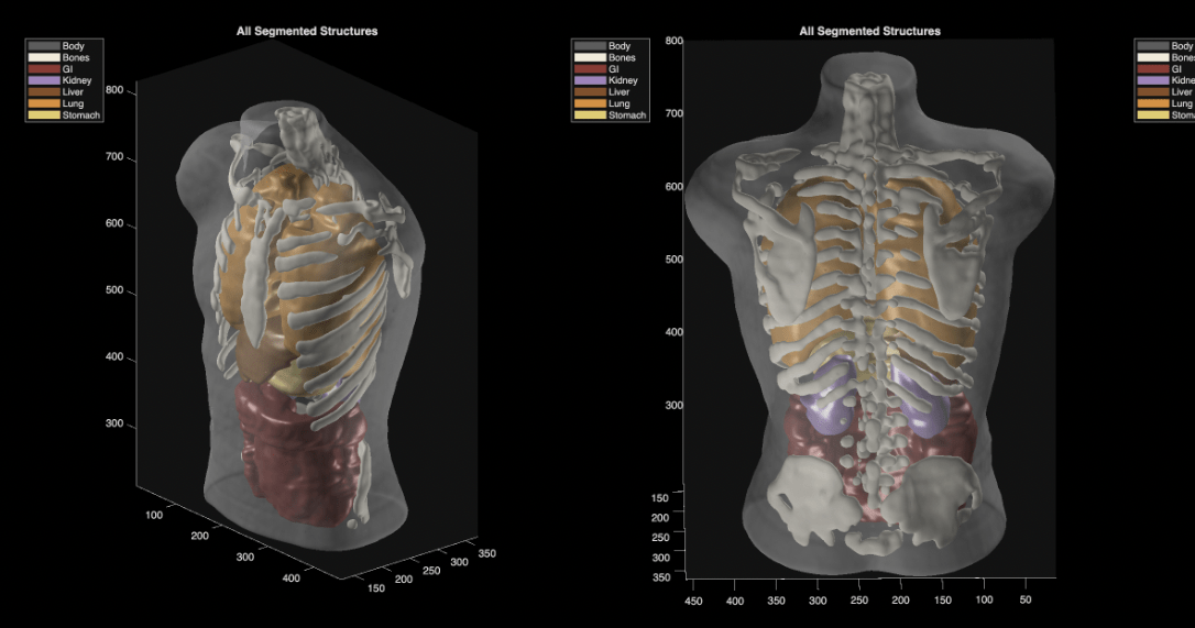 Midjourney, an AI image-generation startup, is pivoting into medical imaging with an ultrasound scanner that would scan users in water, but medical experts say the company has provided little evidence to support its claims that the device could match MRI quality.